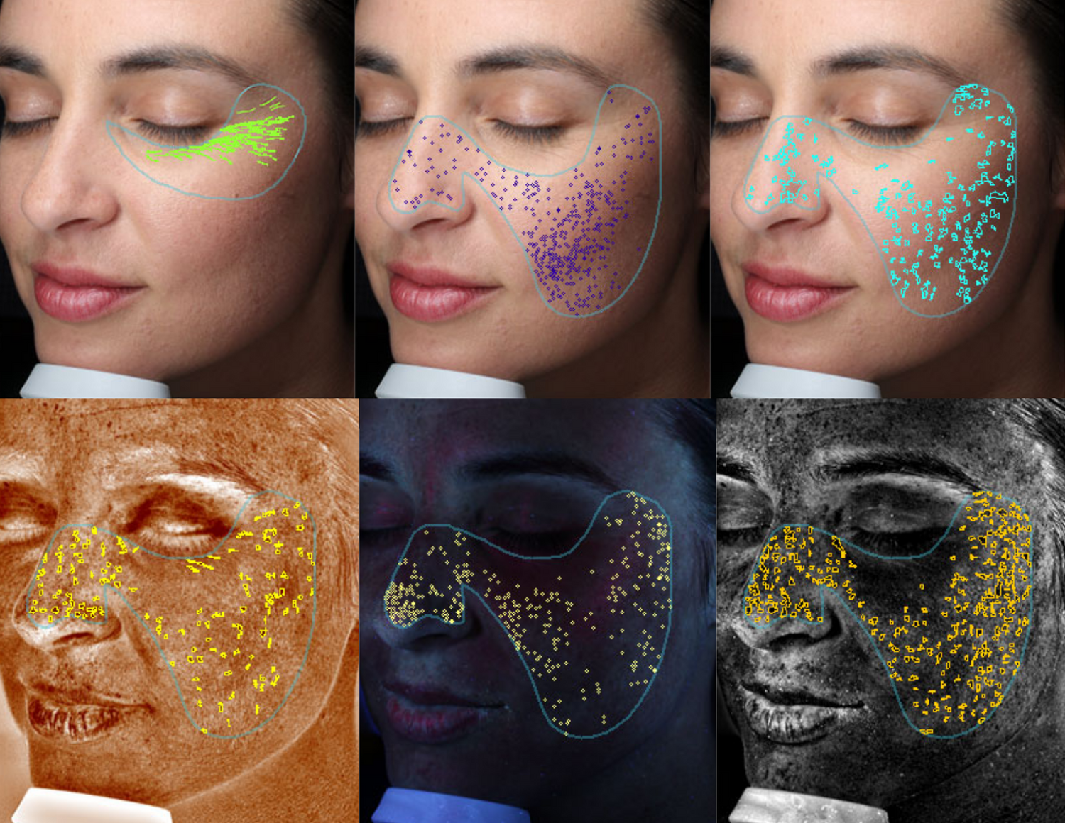 Visia 3D Skin Analysis